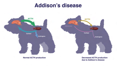 Morbus Addison