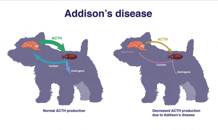 Morbus Addison